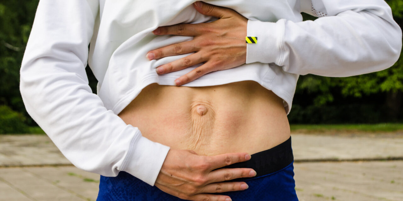 How Do I Know If I Have Diastasis Recti Abdominis and What Exercises Are Safe to Do If I Have It?