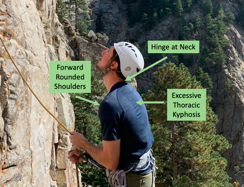 How to Treat Belayer’s Neck