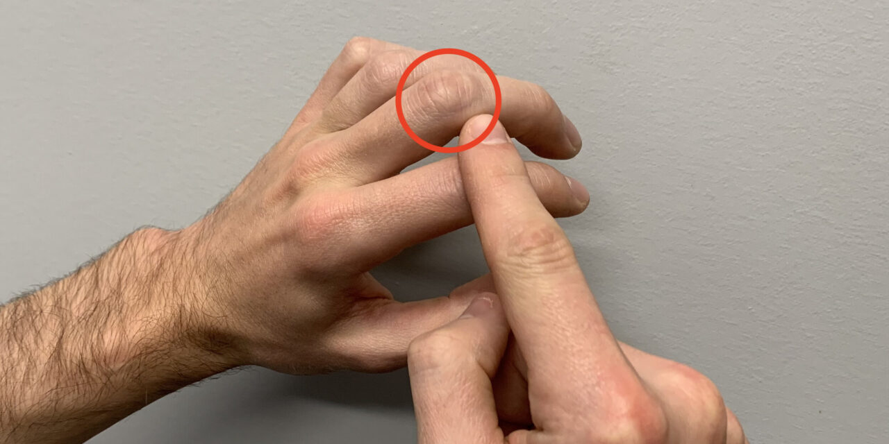 How to Identify a Finger Growth Plate Injury in Youth Rock Climbers