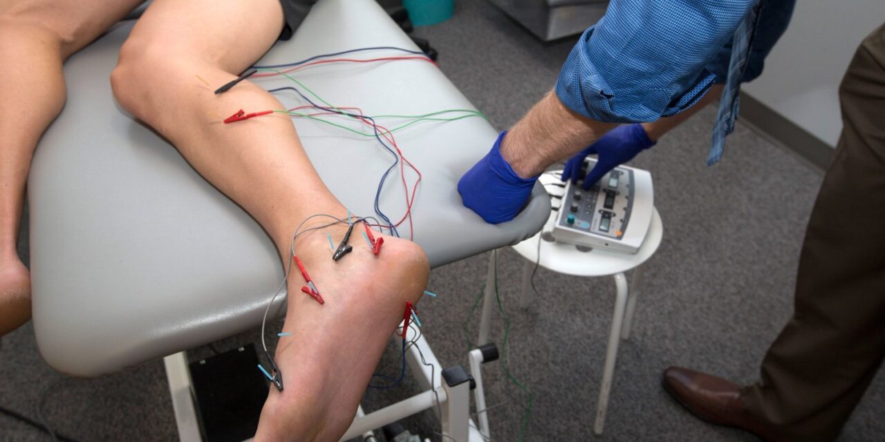 How Does Dry Needling with Electrical Stimulation Improve Symptoms?