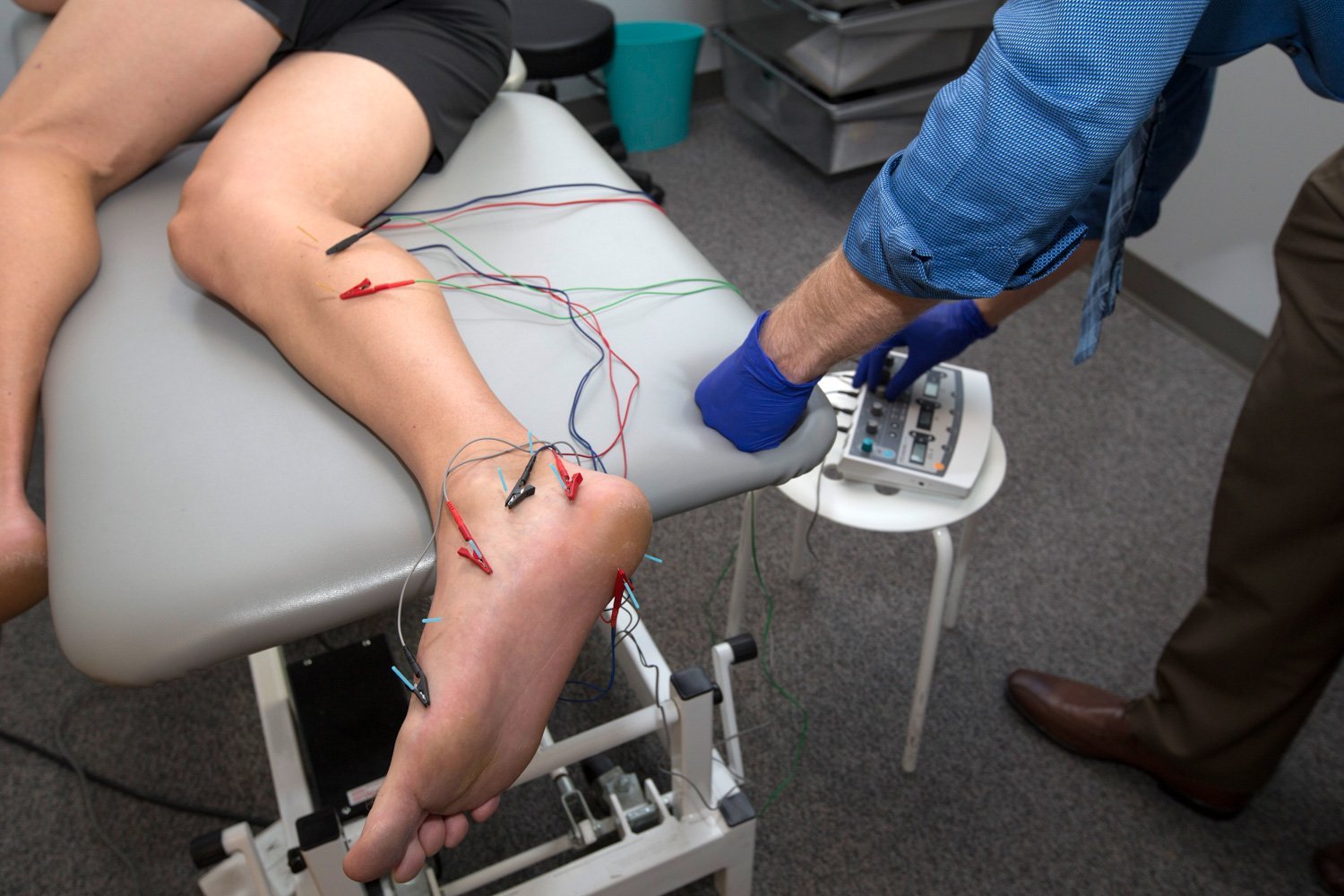 How effective is physical therapy dry needling with electrical