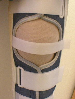 ACL-bracing-post operative-knee injury