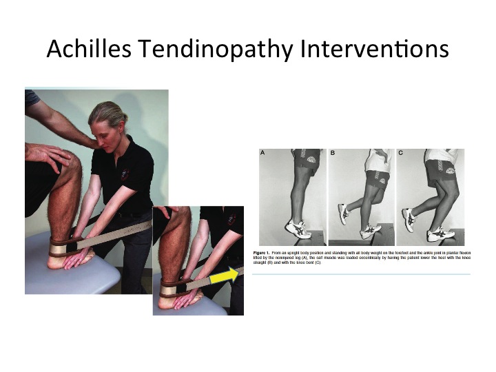 Achilles Tendinopathy Solutions