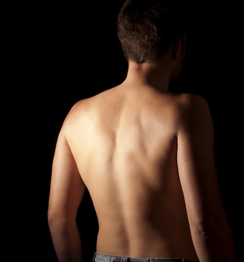 The Effect of Posture on Shoulder Pain