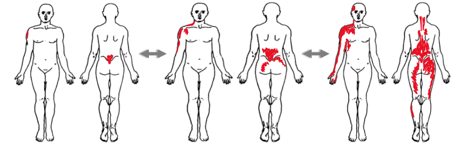 https://www.mendcolorado.com/wp-content/uploads/2023/08/Chronic-Pain-Persistent-physical-therapy.jpg