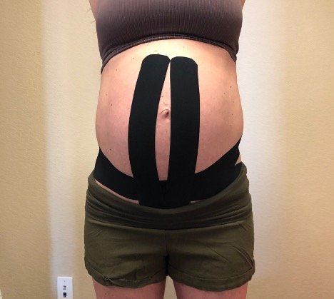 Pregnancy Tape - Helps with Pelvic, Belly and Back Support