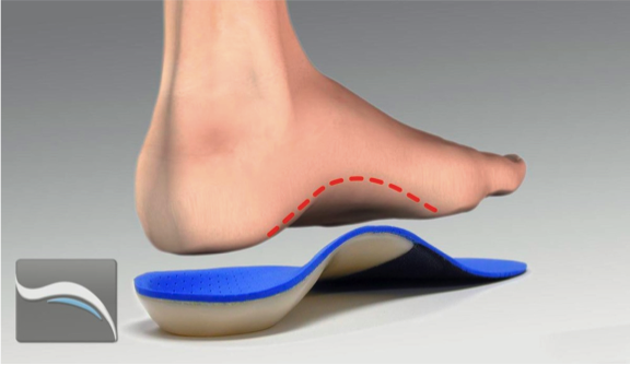 Over The Counter Orthotics For Plantar Fasciitis Hot Sale ...