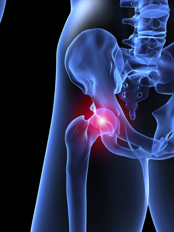 hip-impingement-surgery-physical-therapy-treatment