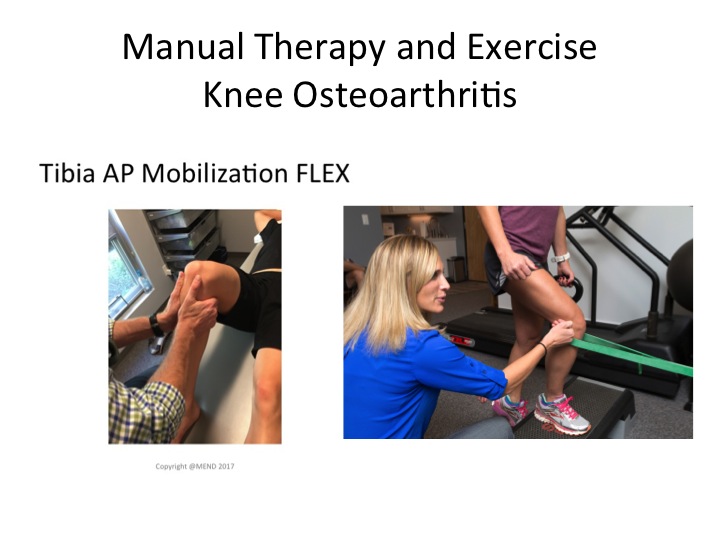knee-arthritis-treatment-exercise-cost