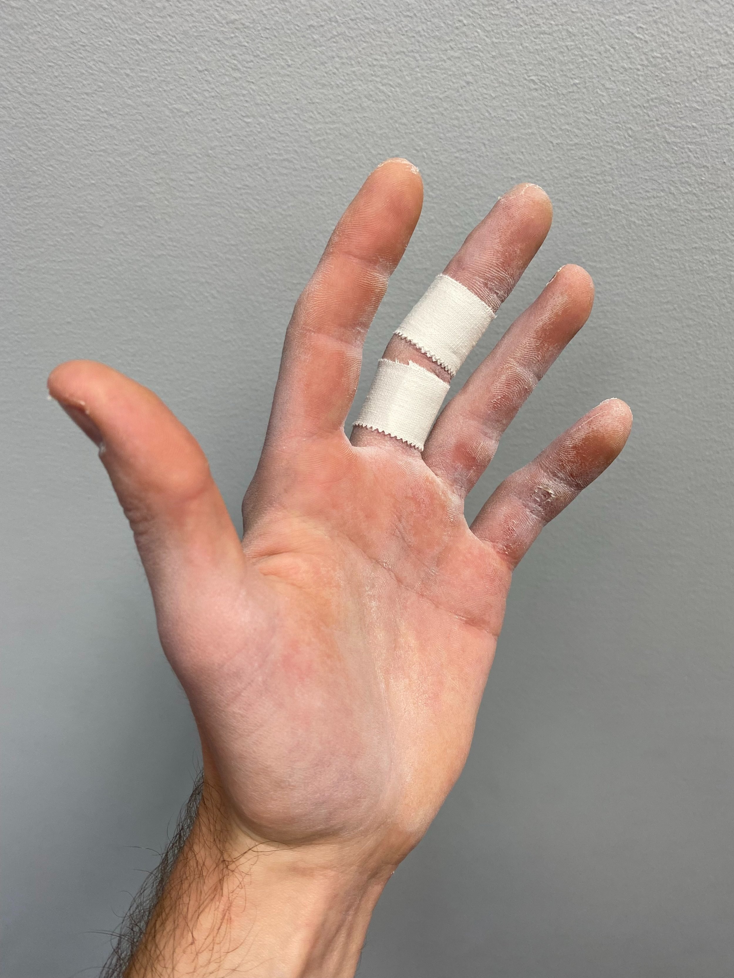 Does Finger Taping Improve Finger Strength In Climbers? - Mend