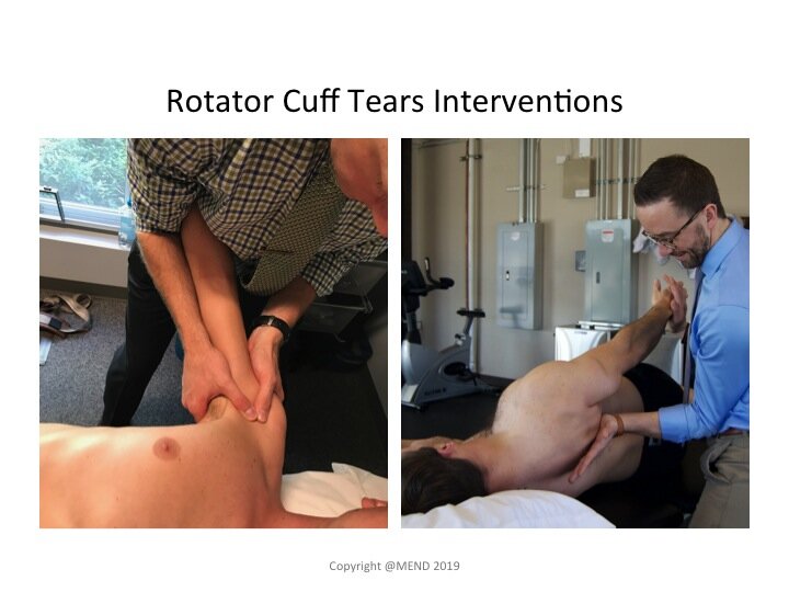 Can Physical Therapy Help With A Rotator Cuff Tear? - Mend Colorado