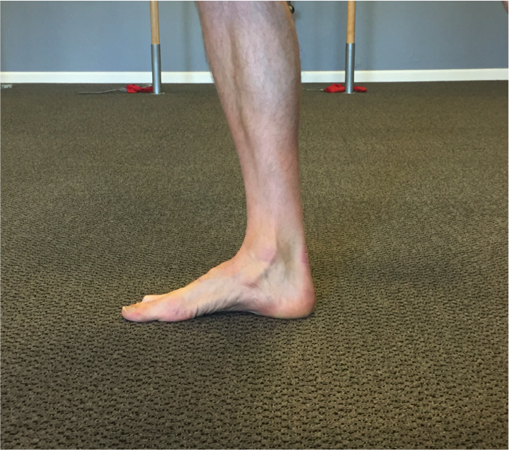 short foot exercise-heel pain-mobility-strengthening