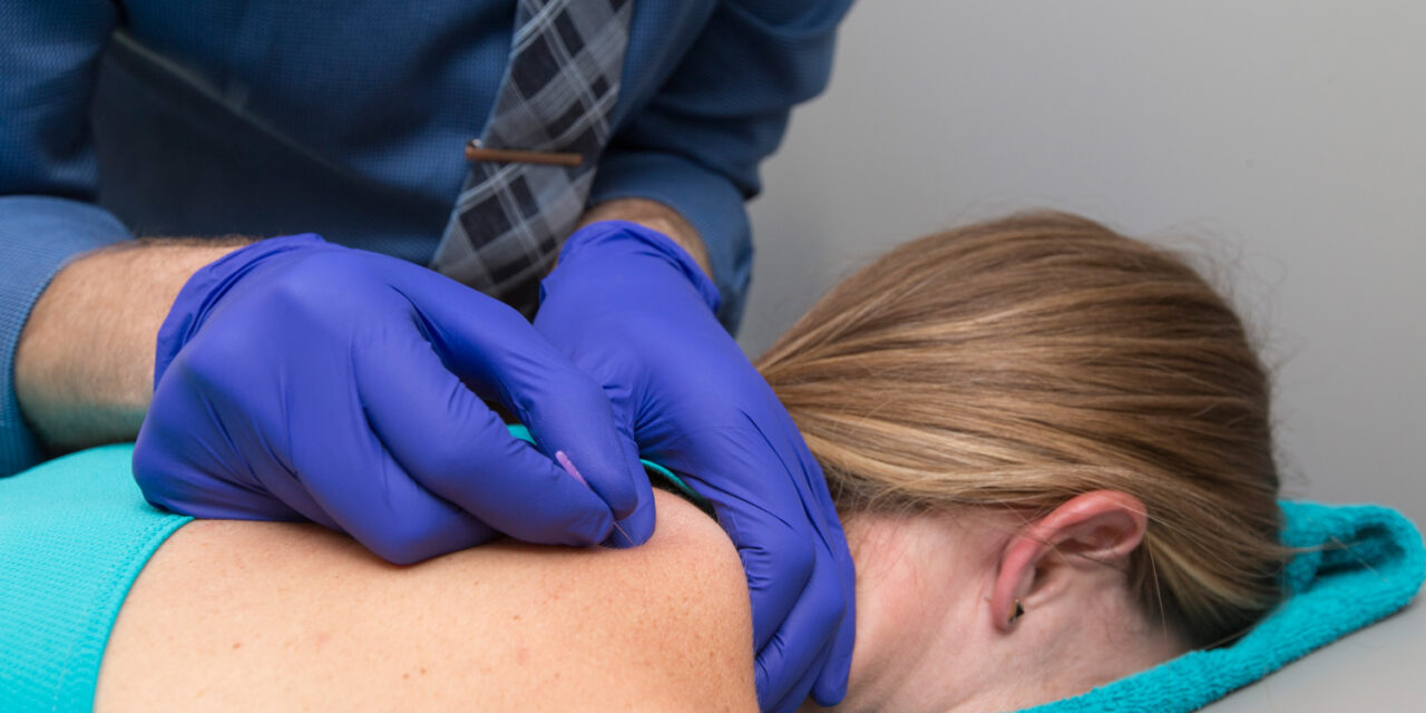 Does Adding Dry Needling To Physical Therapy Treatments Improve Shoulder Pain?