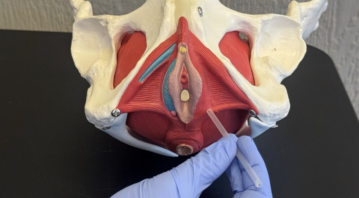 Dry Needling for Pain After Perineal Tears