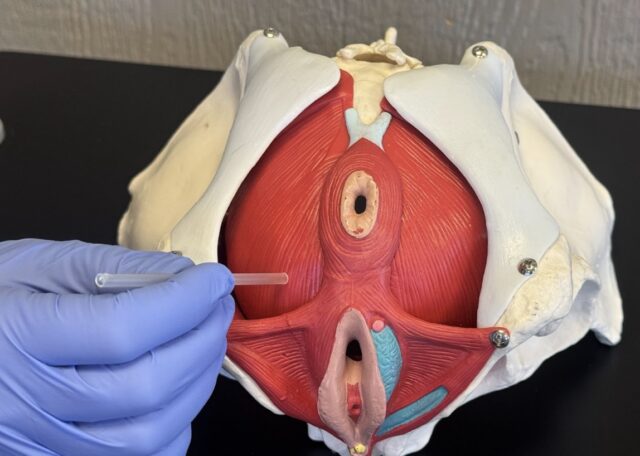 Dry needling for pelvic pain